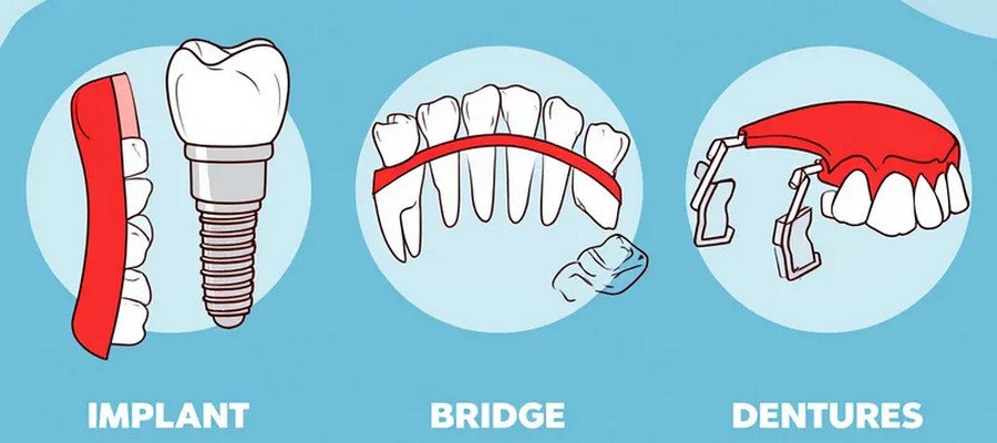 What's the Difference