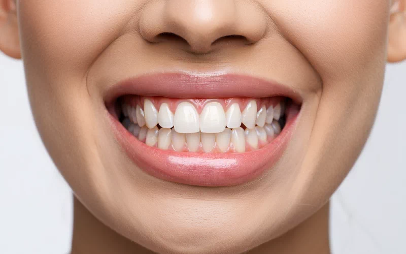 Cosmetic Dentistry to Enhance Your Smile