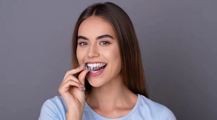 Invisalign Cost in Fairfax
