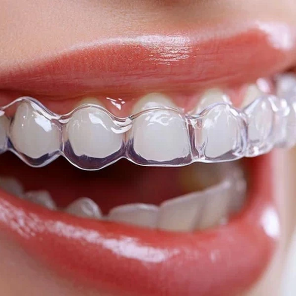 Clear Aligners Invisalign in Fairfax