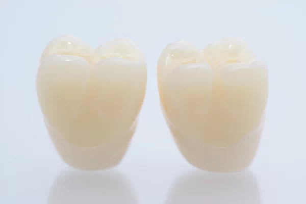 Dental Crowns