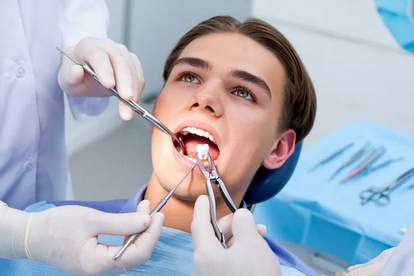 Tooth Extraction