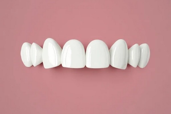 Porcelain Veneers